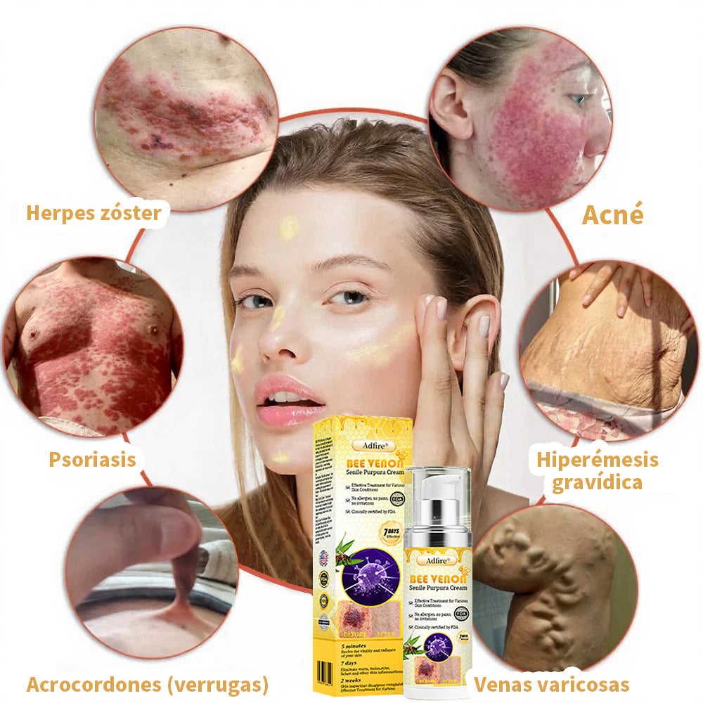 🐝𝐓𝐢𝐞𝐧𝐝𝐚 𝐨𝐟𝐢𝐜𝐢𝐚𝐥🇺🇸🐝 𝐀𝐃𝐅𝐈𝐑𝐄® 𝐂𝐫𝐞𝐦𝐚 𝐝𝐞 𝐕𝐞𝐧𝐞𝐧𝐨 𝐝𝐞 𝐀𝐛𝐞𝐣𝐚 𝐩𝐚𝐫𝐚 𝐏𝐮́𝐫𝐩𝐮𝐫𝐚 𝐒𝐞𝐧𝐢𝐥: 𝐋𝐚 𝐬𝐨𝐥𝐮𝐜𝐢𝐨́𝐧 𝐢𝐧𝐭𝐞𝐠𝐫𝐚𝐥 𝐩𝐚𝐫𝐚 𝐩𝐢𝐞𝐥 𝐟𝐫𝐚́𝐠𝐢𝐥 𝐲 𝐟𝐥𝐚𝐜𝐢𝐝𝐞𝐳 ✅ 𝐅𝐃𝐀 𝐑𝐞𝐠𝐢𝐬𝐭𝐫𝐚𝐝𝐚